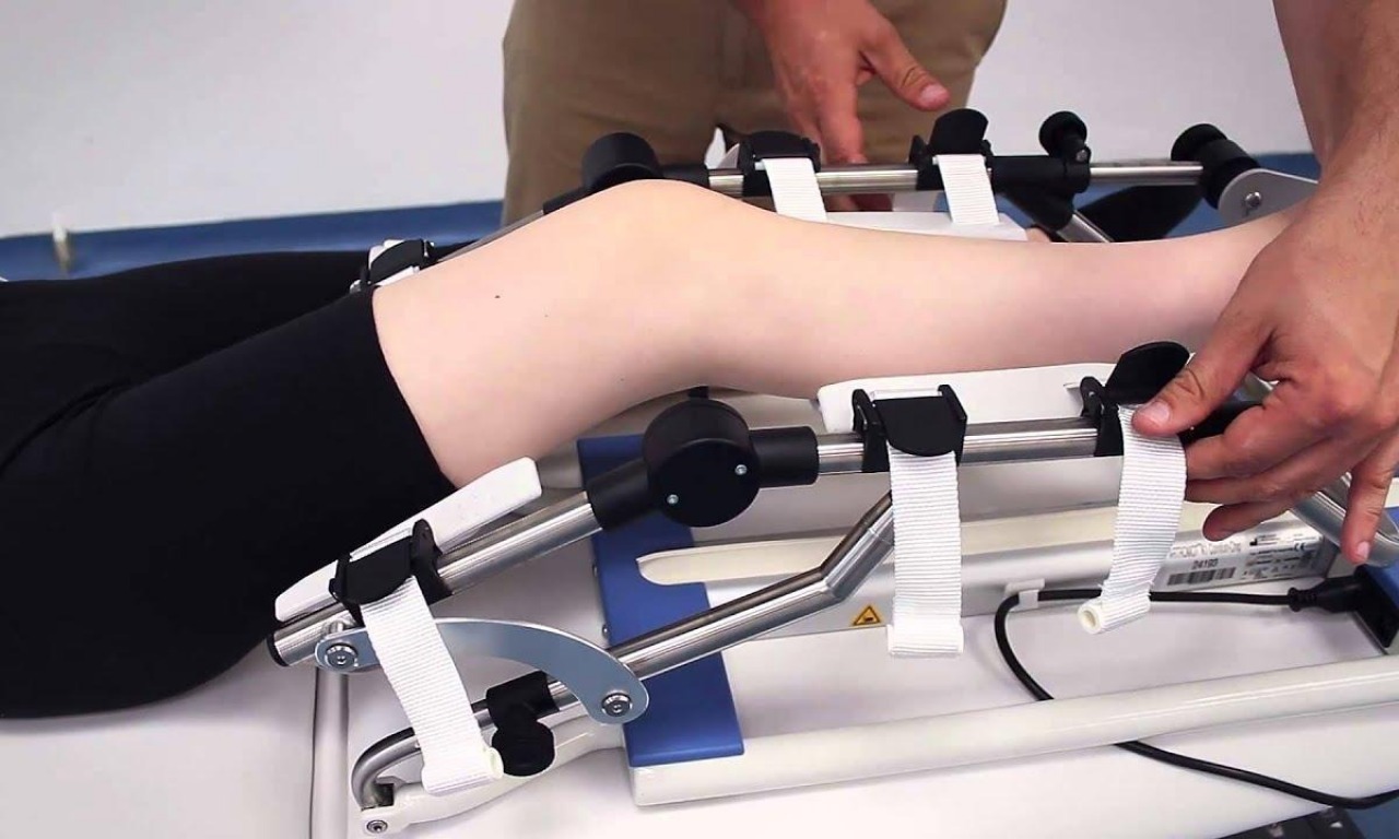 Riabilitazione precoce nella fase post-operatoria
