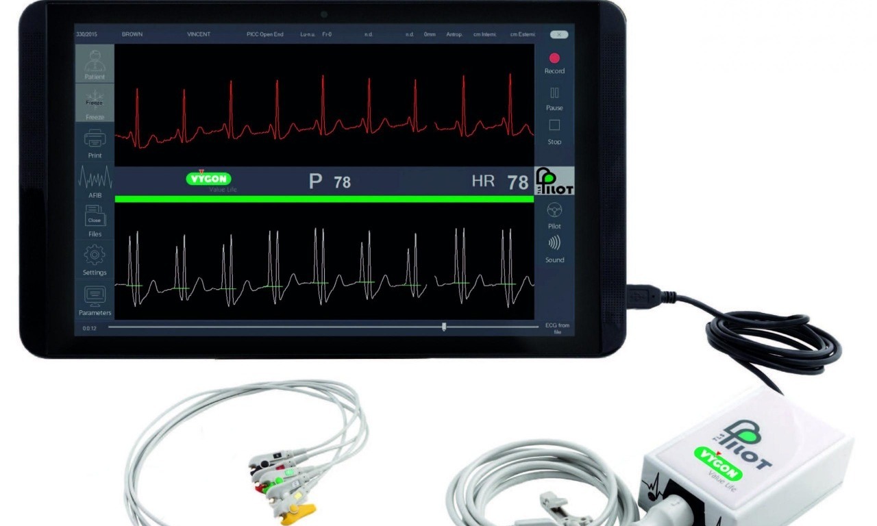 PILOT, Sistema ECG Intracavitario